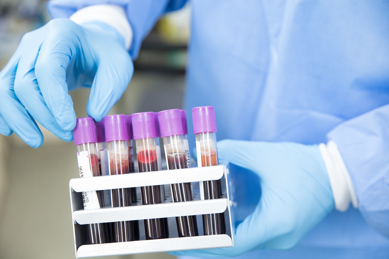 What Is the Most Common Risk of Exposure to Bloodborne Pathogens for Healthcare Workers?