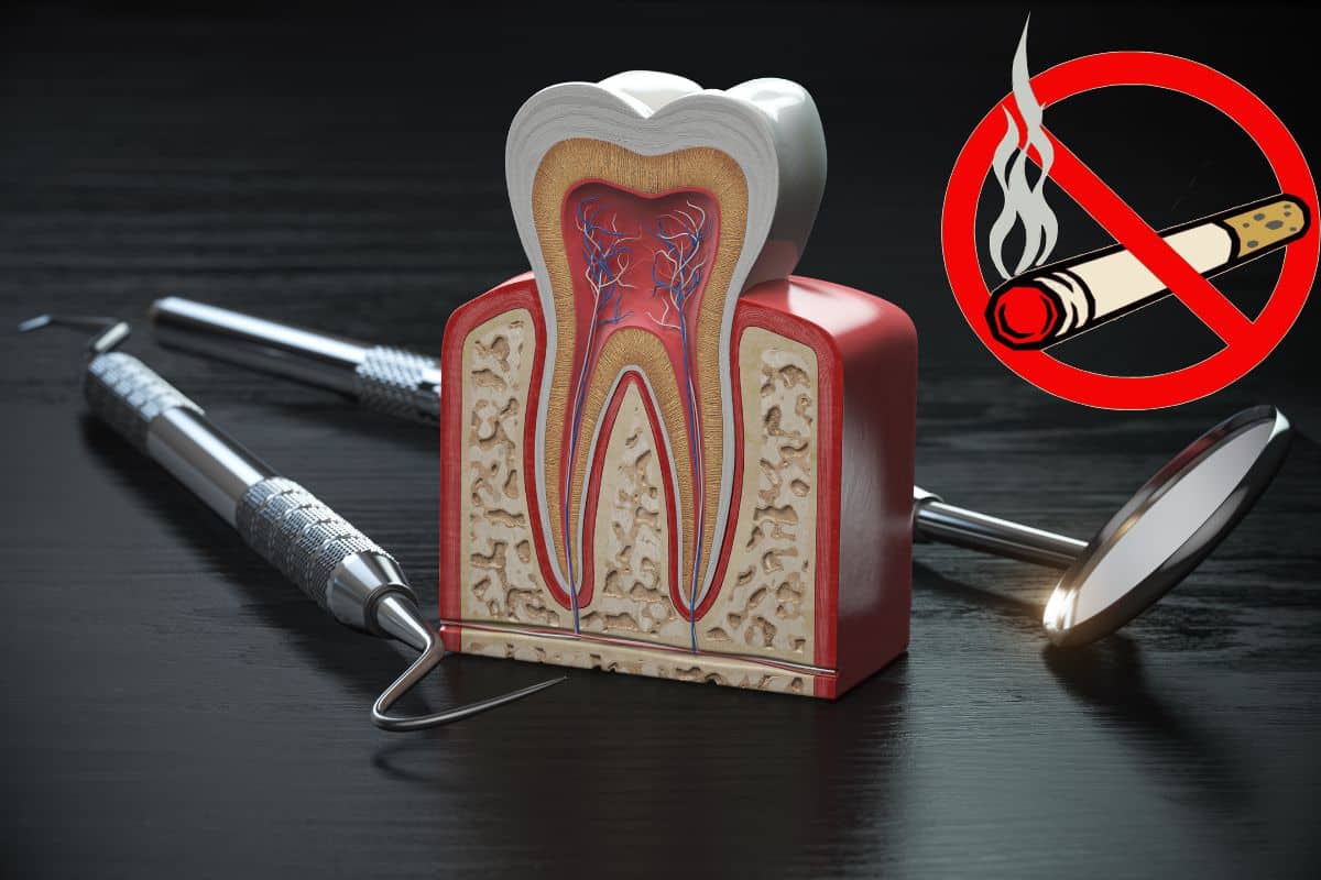 smoke After a Root Canal